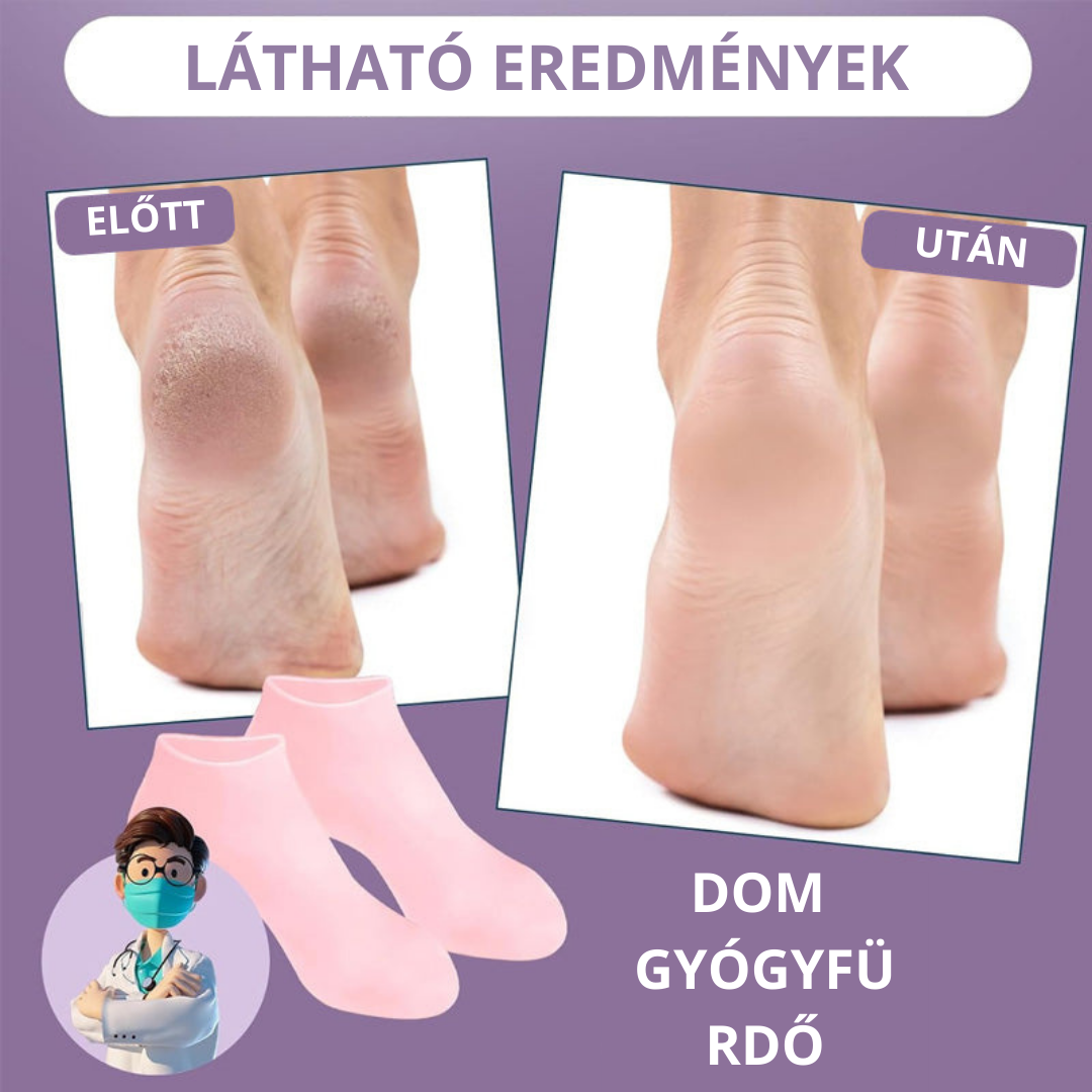 Szilikon Lábápoló Zoknit